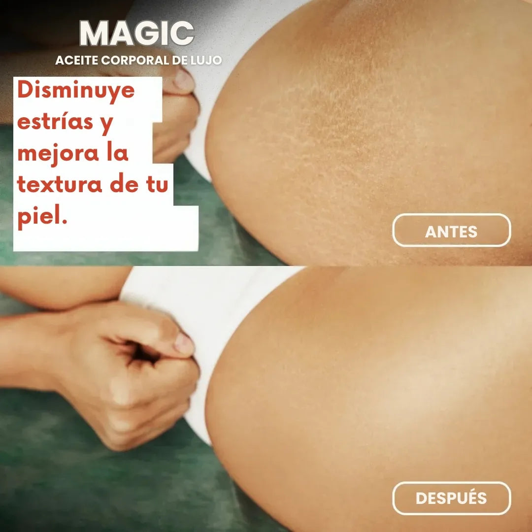 Aceite corporal Mágic Besque™